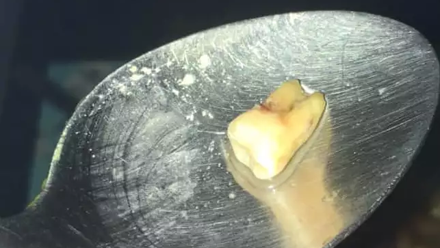 ludzki ząb